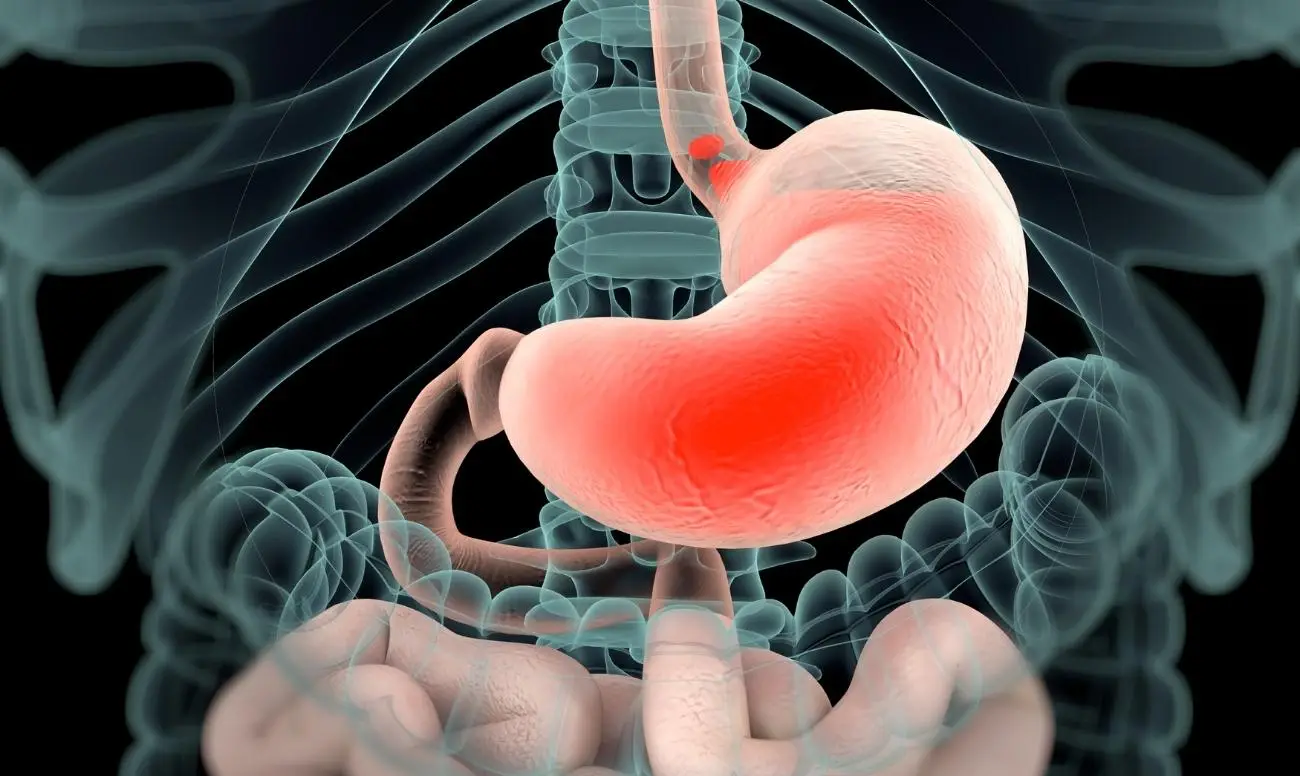 Stomaco e intestino infiammati? Ecco la tisana potente che li disinfiamma subito